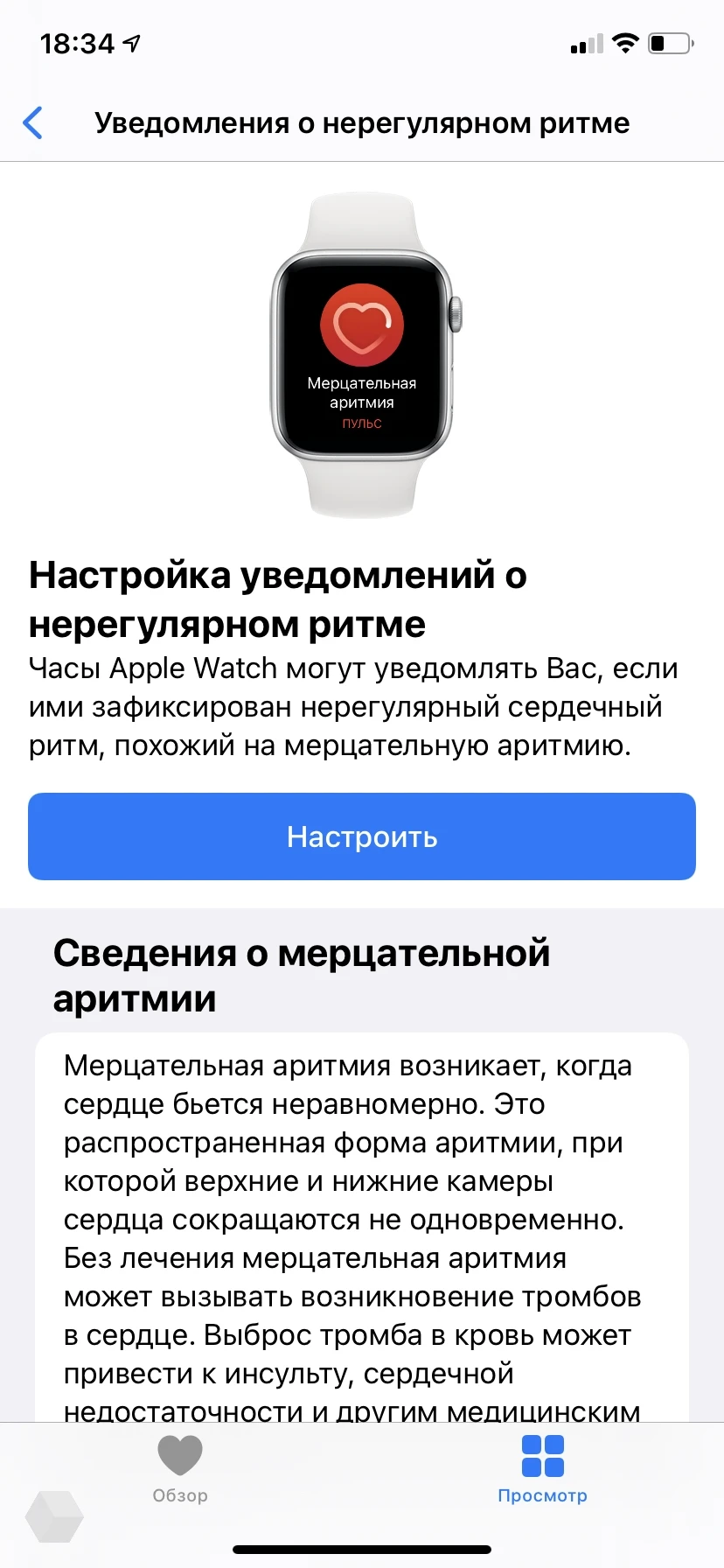 Функция Мерцательная аритмия