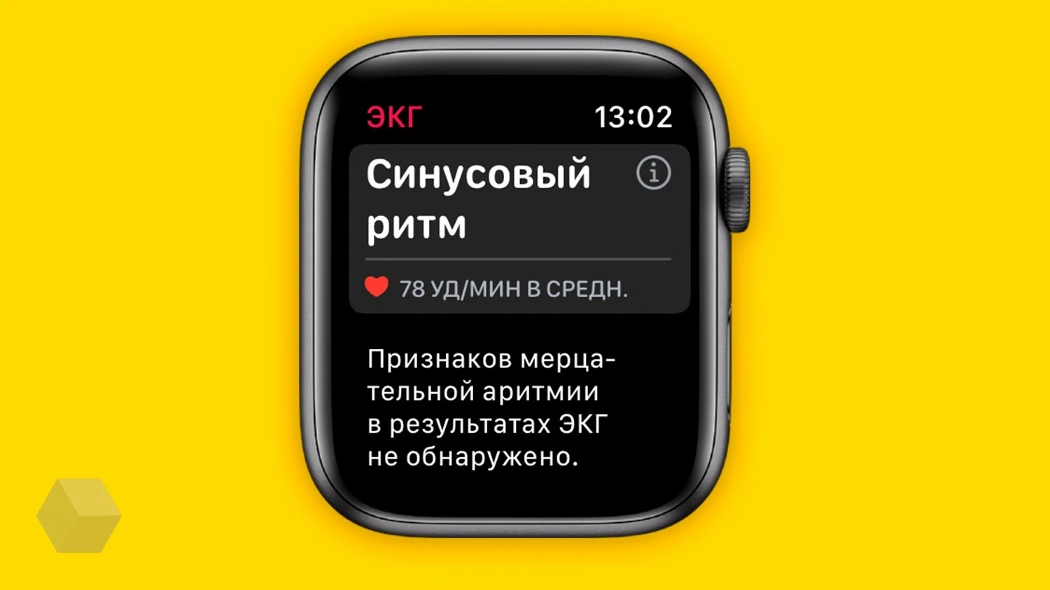 ЭКГ Apple Watch